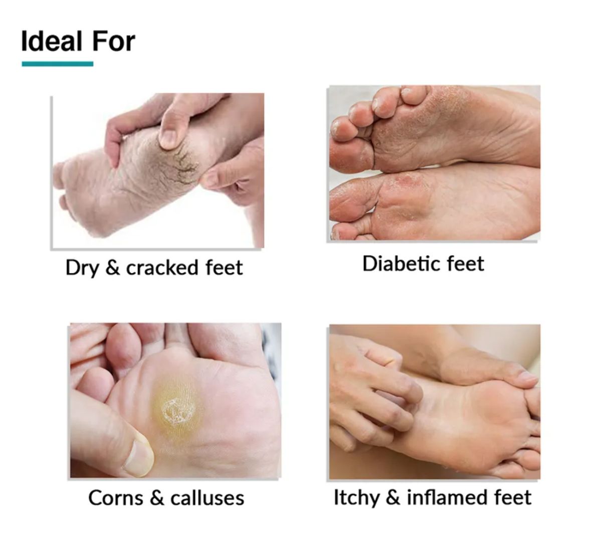 HAIQA FOOTCRACK CREAM-25g-HEALTH & PERSONAL CARE-dealsplant